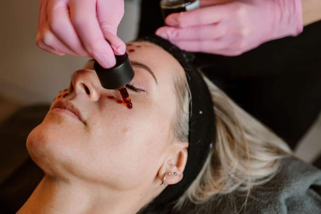 Skintens behandelingen